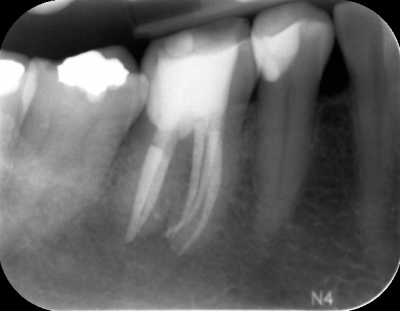 35. EndodontieAbend - Mittwoch, 5. Oktober 2016